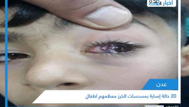 صورة 20 حالة إصابة بمسدسات الخرز معظمهم اطفال في عدن