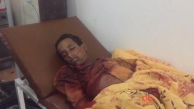 صورة الضالع.. مقتل طفل برصاص قناص حوثي في قعطبة