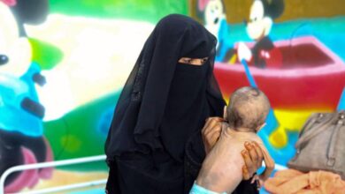 صورة عبث مليشيا الحوثي بالقطاع الصحي يرفع من معدلات سوء تغذية الأطفال