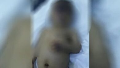 صورة وفاة الطفل حسن متأثراً بإصابته جراء مجزرة الحوثيين الدامية في الدريهمي