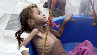 صورة أطباء بلا حدود: اليمن يشهد ارتفاعاً في معدلات الأمراض