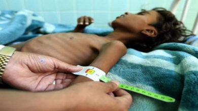 صورة برنامج الأغذية العالمي: 2.3 مليون طفل في اليمن معرضون لسوء التغذية الحاد