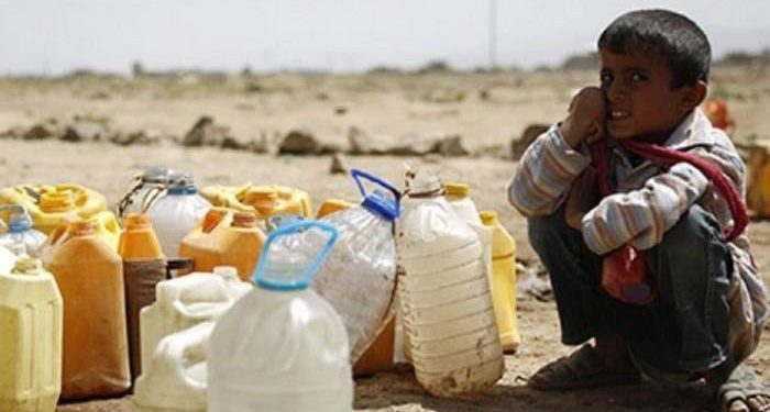مجاعة الاطفال في اليمن 700x375