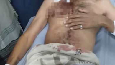 صورة إصابة شخص باشتباكات قبلية في شبوة