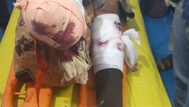 صورة إصابة أحد مهندسي “مسام” بانفجار لغم حوثي غرب تعز