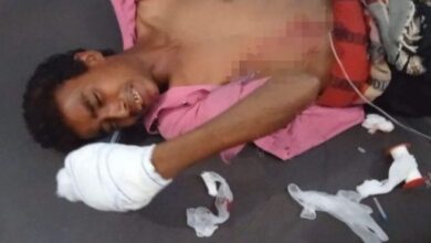 صورة الحُديدة اليمنية.. إصابة مواطن بانفجار جسم من مخلفات مليشيات الحوثي غرب حيس