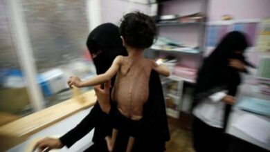 صورة البنك الدولي: 70 % من سكان اليمن يواجهون خطر المجاعة