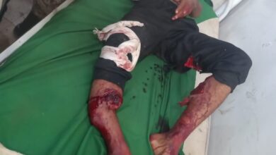 صورة عاجل| شهداء وجرحى في هجوم صاروخي استهدف قاعدة العند الجوية