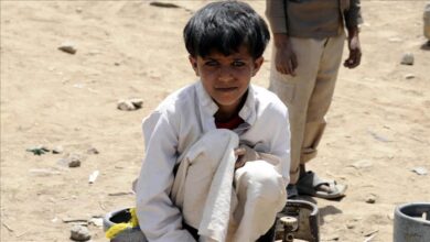 صورة الأمم المتحدة: سوء التغذية الحاد يهدد حياة 1.8 مليون طفل يمني