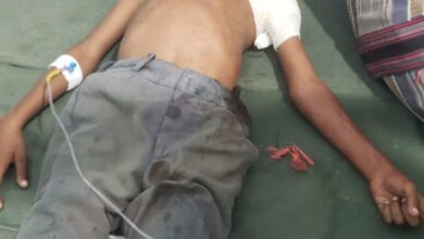 صورة إصابة طفل برصاص مليشيا الحوثي في #حيس اليمنية