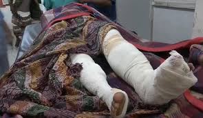 صورة إصابة امرأة بجروح بليغة إثر قصف حوثي على #التحيتا اليمنية