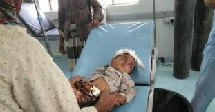 صورة إصابة طفل بشظايا قذيفة حوثية في مديرية جبل راس بالحديدة اليمنية