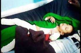 صورة هجوم أسد على طفلة يفقد يدها في إب اليمنية