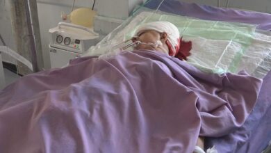 صورة وفاة امرأة متأثرة بإصابتها برصاص قناص حوثي في تعز اليمنية