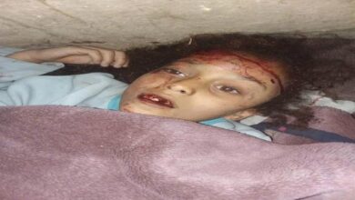 صورة في أول أيام رمضان ..مواطن يمني يقتل طفلته بطريقة بشعة