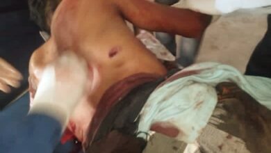 صورة مقتل مواطنين شقيقين برصاص قناصة مليشيات الحوثي شمال الضالع