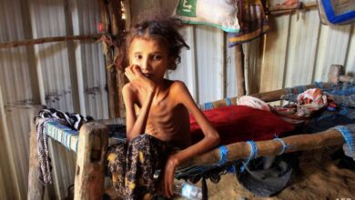 صورة تداعيات الحرب الحوثية.. أرقام أممية توثق مأساوية الأزمة الغذائية