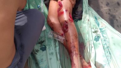 صورة استشهاد مواطن واصابة آخر بقصف مليشيات الحوثي على قرية هيجة العبد في حيس