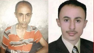صورة صورة تلخص مستوى التعذيب الذي يتعرض له الصحفيون في سجون مليشيات الحوثي