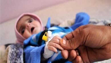 صورة 2.2 مليون طفل يمني يعانون سوء التغذية الحاد