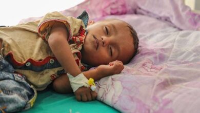 صورة بلا حدود تكشف عن 5 أسباب لارتفاع معدلات سوء التغذية الحاد بين الأطفال باليمن