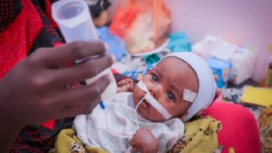صورة “الصحة العالمية” تعلن علاج 2255 طفلًا مصابًا بسوء التغذية في اليمن