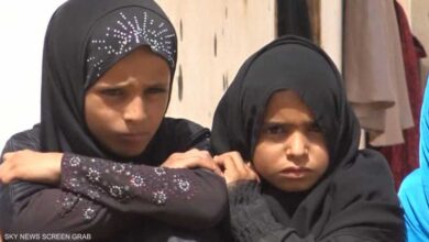صورة “يونيسف”: أكثر من مليوني طفل باليمن يعانون من سوء تغذية حاد