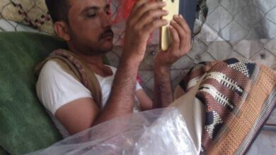 صورة مقتل نحال من أبين على يد عصابة مسلحة في إب اليمنية