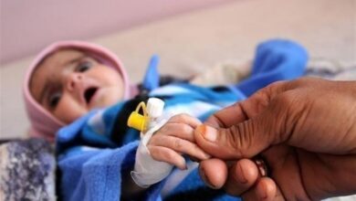 صورة البنك الدولي يوافق على منحة جديدة لدعم الصحة والغذاء في اليمن