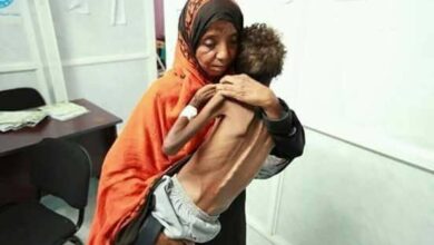 صورة تقرير أممي يتوقع أن يتفاقم مستوى انعدام الأمن الغذائي الحاد في اليمن