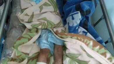 صورة لغم حوثي يتسبب في بتر قدم طفل بالبيضاء اليمنية