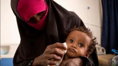 صورة الغذاء العالمي: إيقاف برنامج الوقاية من سوء التغذية سيترك ملايين الأطفال باليمن عرض للأمراض