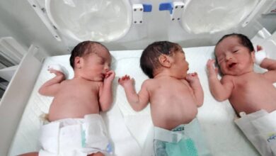 صورة ولادة نادرة لـ “توأم ثلاثي” في هيئة مستشفى مأرب العام